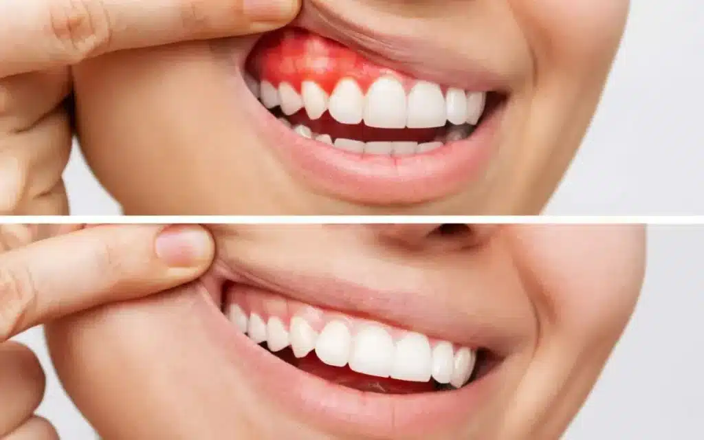 shutterstock 2125599860 1080x675 1