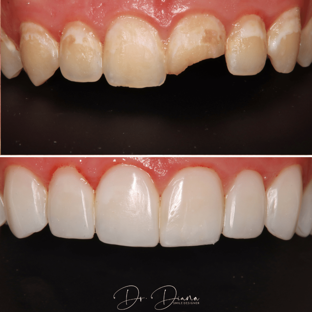 template for posts2 16